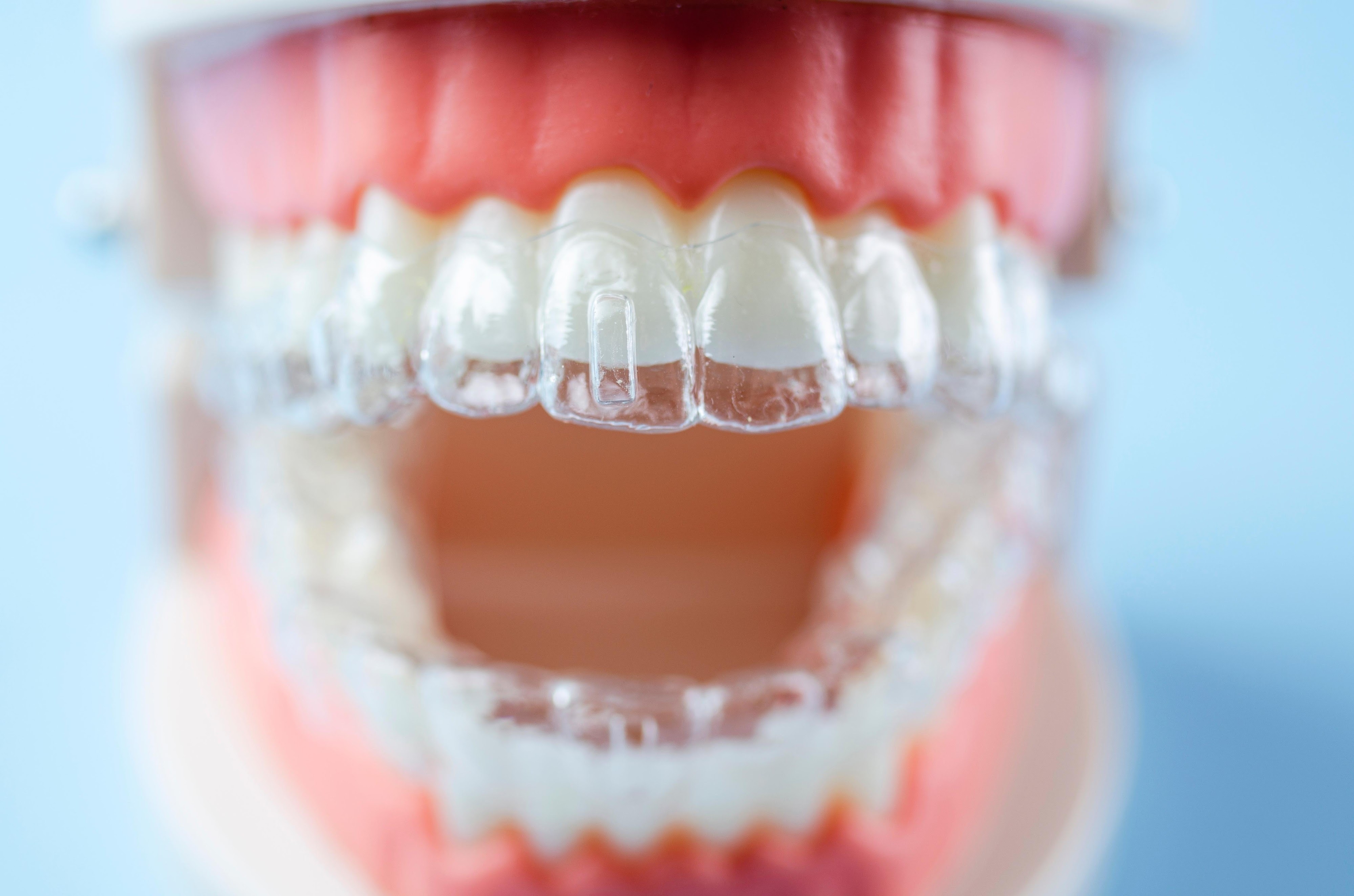 Invisalign Clear Aligners